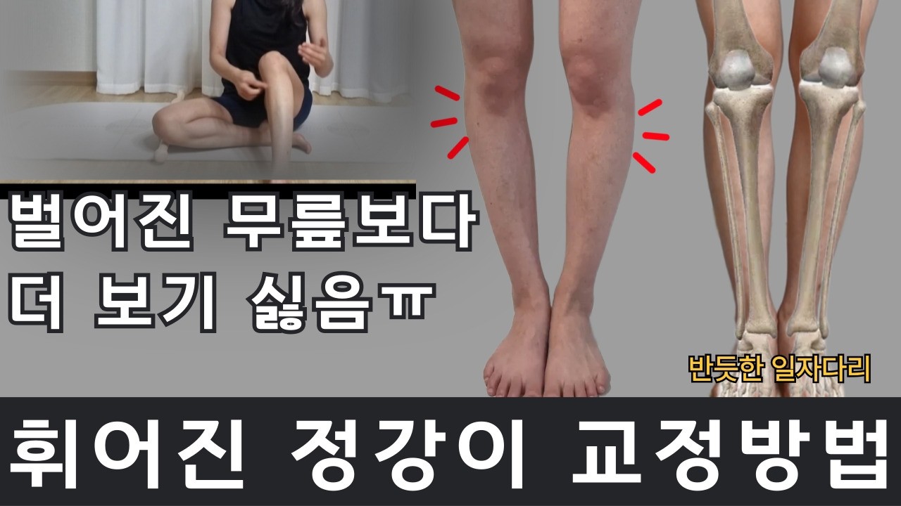 무릎 아래가 휘어졌다면 꼭 따라해보세요! 오다리 교정운동(feat.무릎 안쪽 통증)