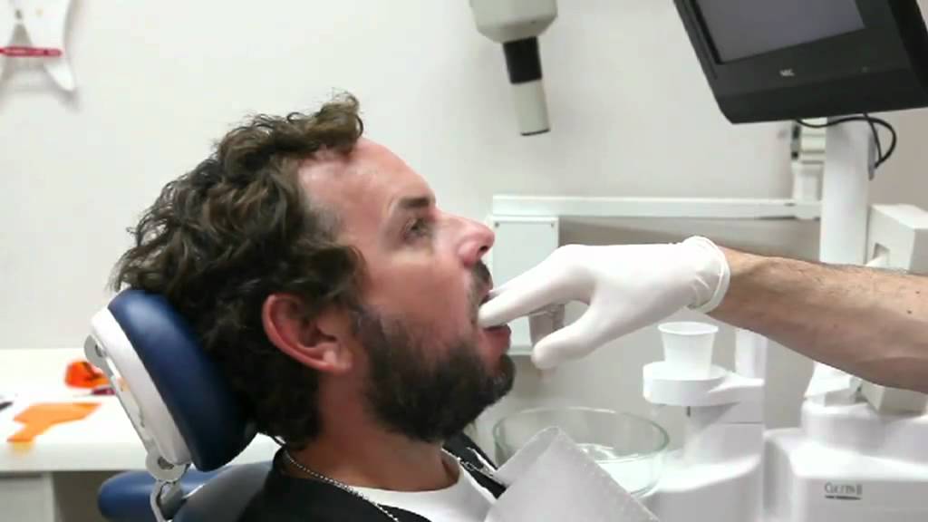 Dr.Levi from the SmileShop Gives Ian a Makeover