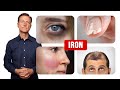 How iron affects your hair skin and nails