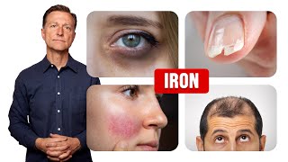 How Iron Affects Your Hair, Skin and Nails screenshot 5