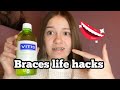 Braces life hacks/ my experience🦷 | vidmas day 5🎄