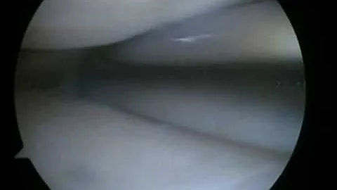 Em quais cirurgias deve ser administrado o antibiótico profilático obrigatoriamente?