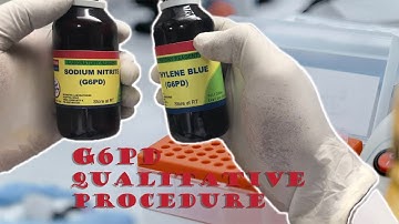 G6PD deficiency qualitative test