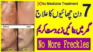 No Frankels No Malazmachaiaaa Malazma Removedby Dr Zimal