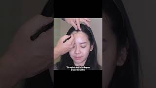 She Lowered Her Hairline Without Forehead Surgery