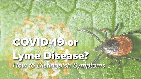 Distinguishing The Signs & Symptoms of COVID-19 from Acute Lyme Disease | Johns Hopkins Rheumatology