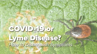 Distinguishing The Signs &amp; Symptoms of COVID-19 from Acute Lyme Disease | Johns Hopkins Rheumatology