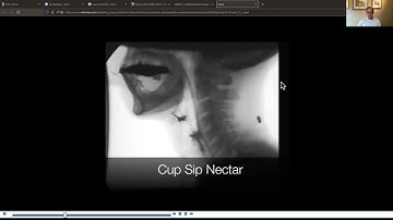 MBSImp Reliability Recording for Case Study