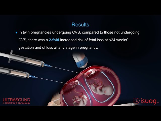 Chorionic Villus Sampling Ultrasound