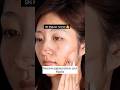 🔥Remove pigmentation, Dark sports and marks naturally at home #viral #shorts #ytshorts #ytshor #1m