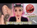 MIS PIERCINGS + EXPERIENCIA l QUELOIDES? Como quitarlos// Septum, Medusa, Nostril, piercing oreja