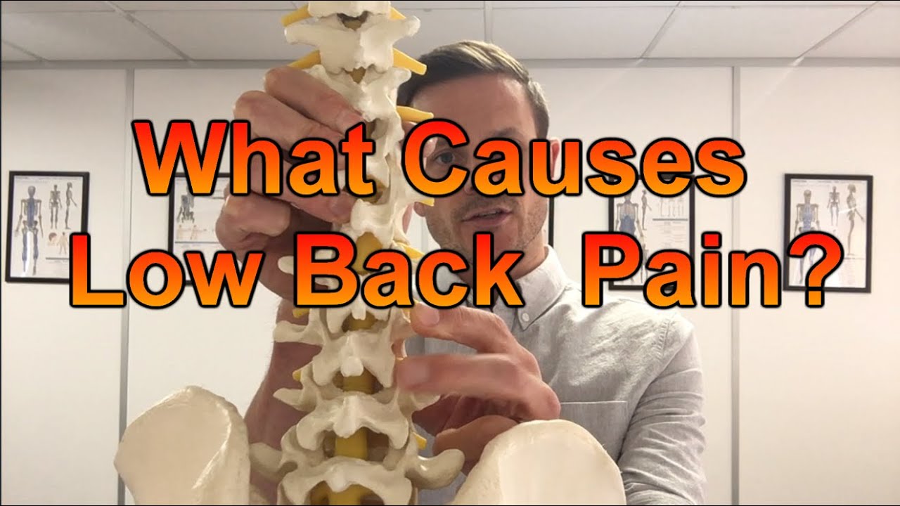 Lower Back Pain Part 1- What Causes Low Back Pain?