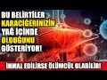 Bu Belirti Karaciğerinizin Yağ İçinde Olduğunu Gösteriyor!