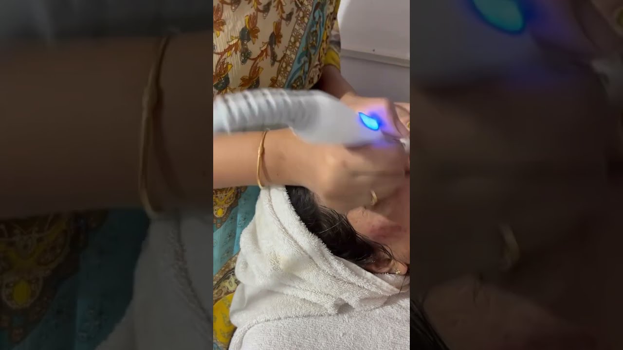Hydra facial available here #sulekhasenorabeautysalon #hydrafacial