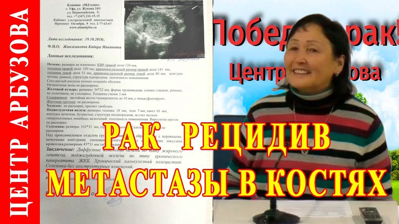 Рак молочной железы, рецидив рака 🦋 Метастазы в костях - YouTube