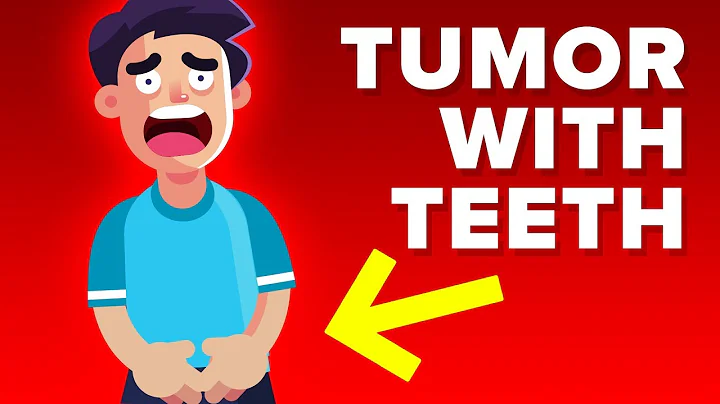 Man Grows Tumor With Teeth Inside Testicles - DayDayNews