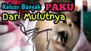 RUQYAH SYAR’IYYAH || KELUAR BANYAK PAKU DARI MULUTNYA