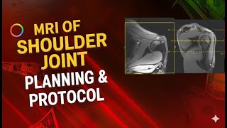 MRI of Shoulder Joint Planning | Complete Protocol & Positioning
