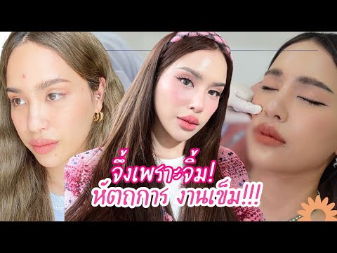My beauty journey รวมประสบการณ์เติมความสวย ver. จิ้มๆฉีดๆ ไม่ลงมีดหมอ l mossster