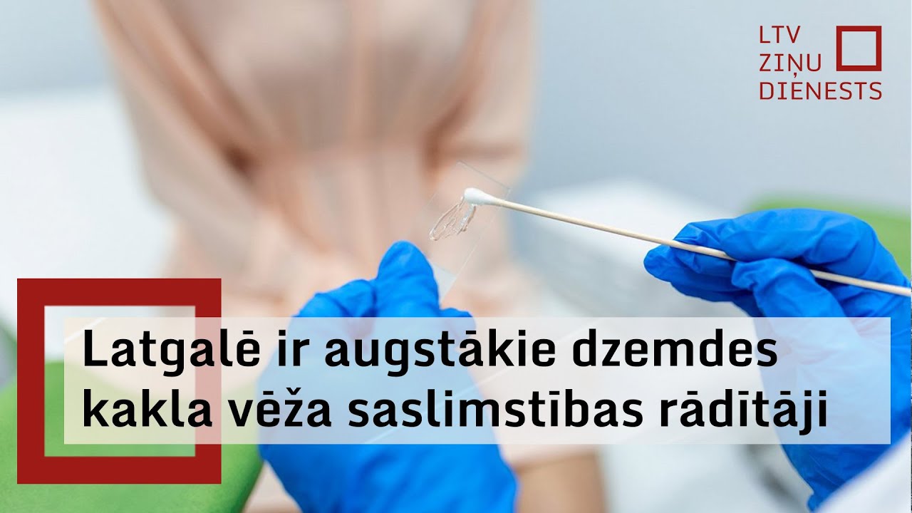 Ginekoloģe: Dzemdes kakla vēža saslimstības rādītāji reģionos ir dažādi, visaugstākie – Latgalē