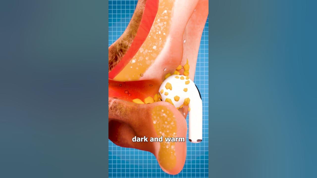 Why Your Earbuds Are GROSS 😨