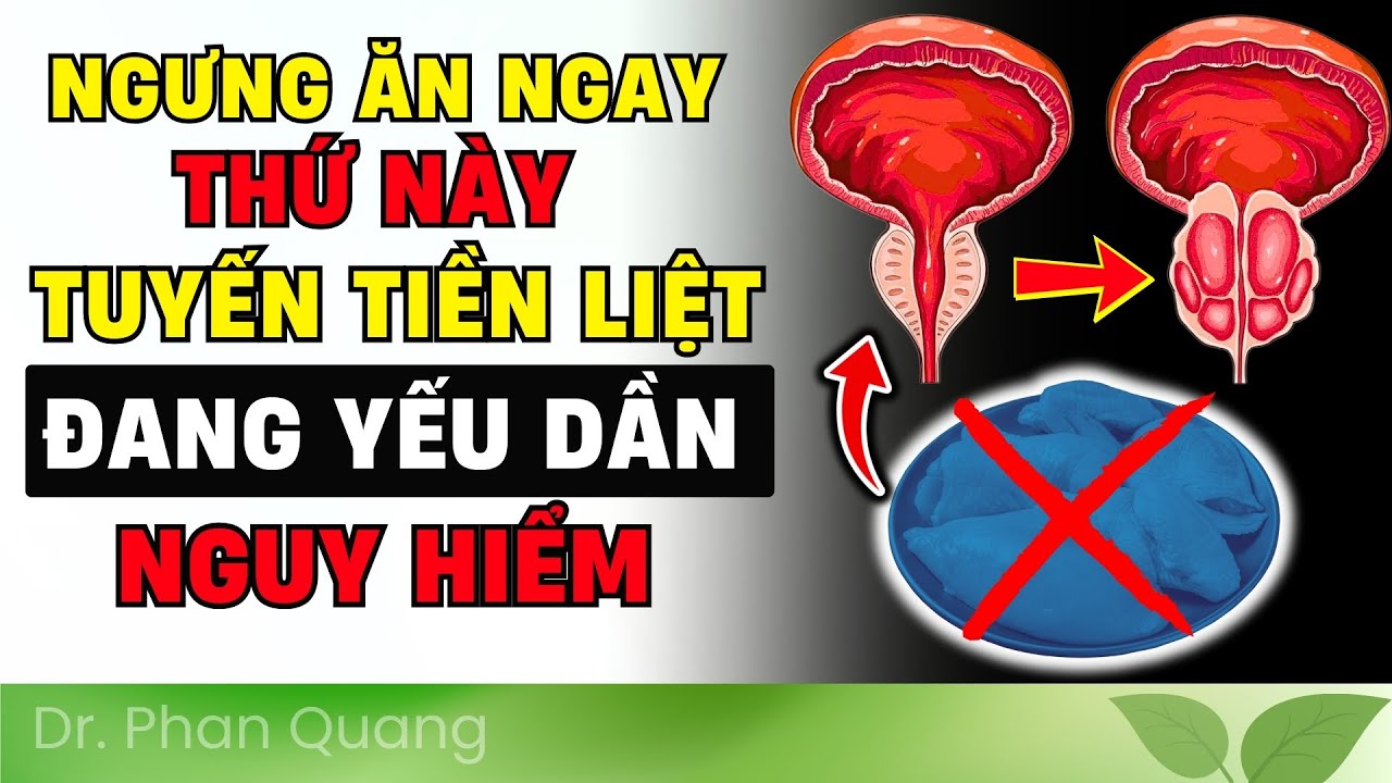 🛑 CẢNH BÁO: 7 THỰC PHẨM LÀM PHÌ ĐẠI TUYẾN TIỀN LIỆT NHANH HƠN TUỔI #drphanquang