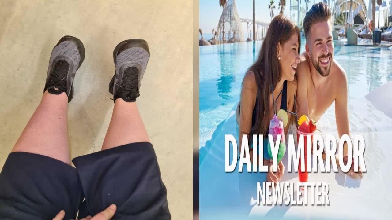 Picture Shows Woman s Giant Leg Caused By Huge Blood Clot After Taking Pill YouTube