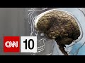 Cognitive Skills and Brain Training
