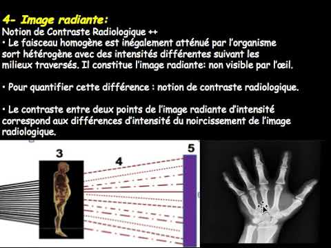 radiographie standard