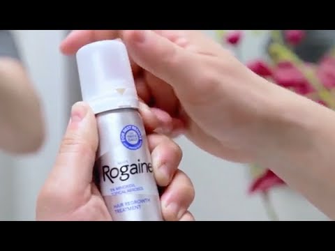 Does Rogaine Work On Frontal Baldness Balding Life