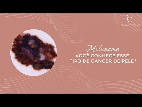 Vídeo: Devo consultar um dermatologista para melanoma maligno?