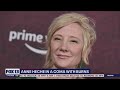 Actress Anne Heche in coma with burns | FOX 13 Seattle