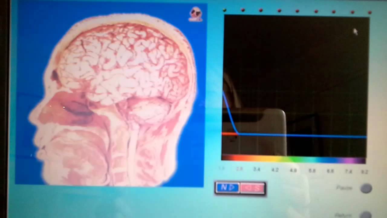 Hair analysis find the cause of symptoms, like weight gain aches and