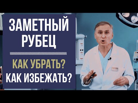 РУБЕЦ 😱 КАК УБРАТЬ ШРАМЫ, КАК ПРЕДОТВРАТИТЬ❓