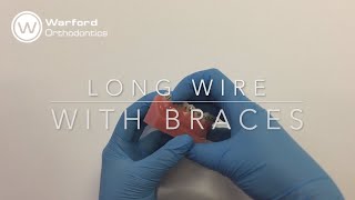 How to Fix a Long Wire or Poking Wire with Braces