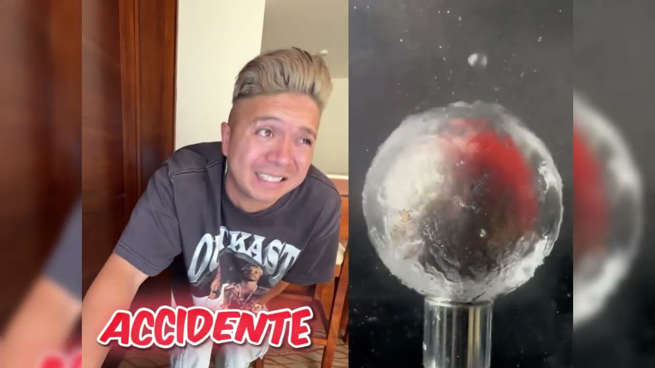 #pov #skit #funny #acting #story#fyp #foryou#foryoupage #fyp シ #fypage #duet #viral #tools