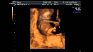 baby's movement at 9 weeks of age