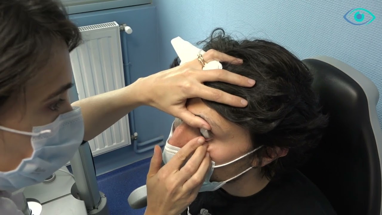 Kératocône : Les lentilles rigides