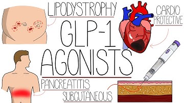 Understanding GLP-1 Agonists