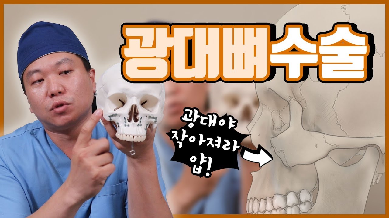 광대뼈수술 어떻게 해요? 광대수술하면 볼이 처지나요?! ㅣ 줌구강악안면외과