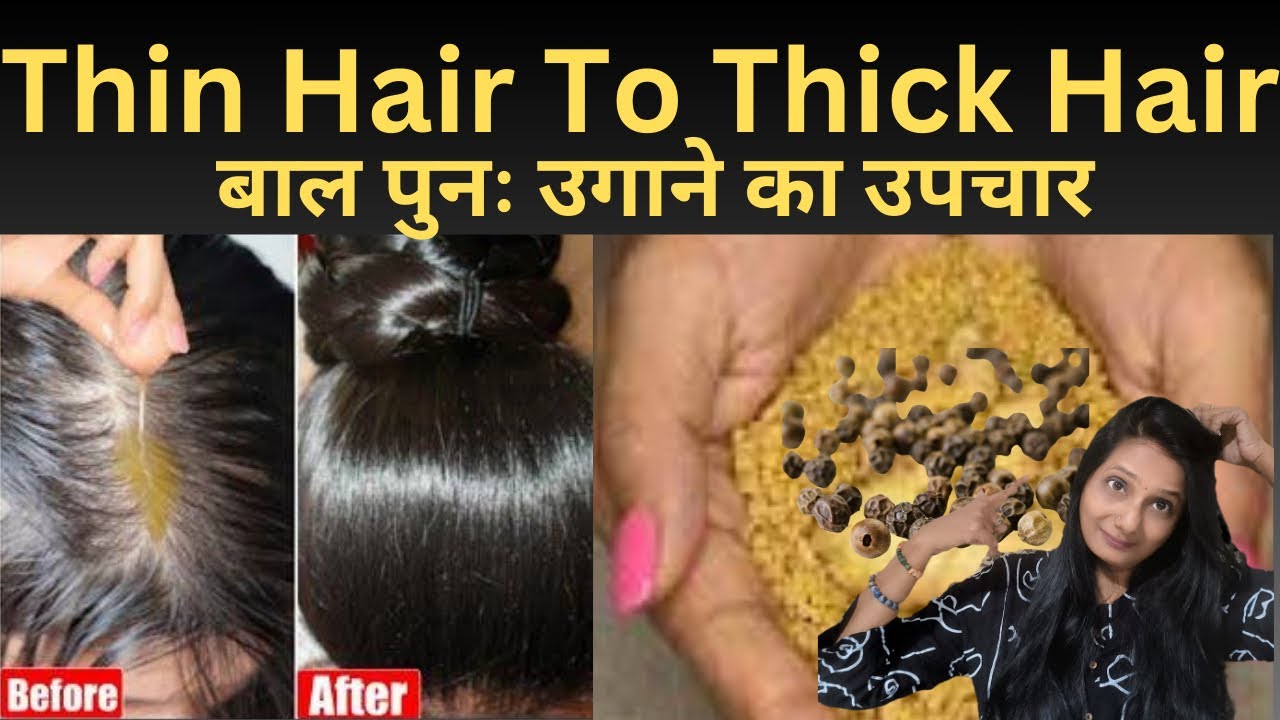 बाल पुनः उगाने का उपचार Hair loss ko Hair growth mai convert करें