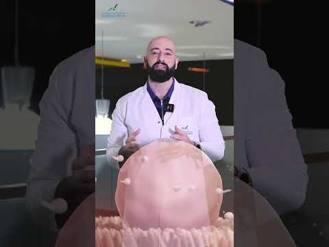 تحديد جنس المولود Baby Gender