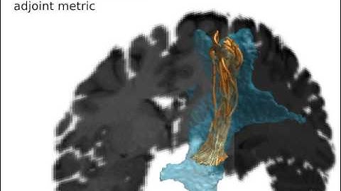 Gaussian Process solutions to the tractography problem
