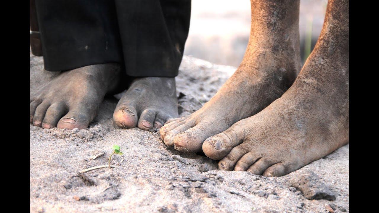 Un Dia En El Lugar Mas Pobre Del Mundo Kadula Sudan Del Sur Youtube