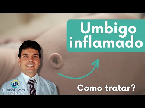 Vídeo: 3 maneiras de tratar uma infecção no umbigo