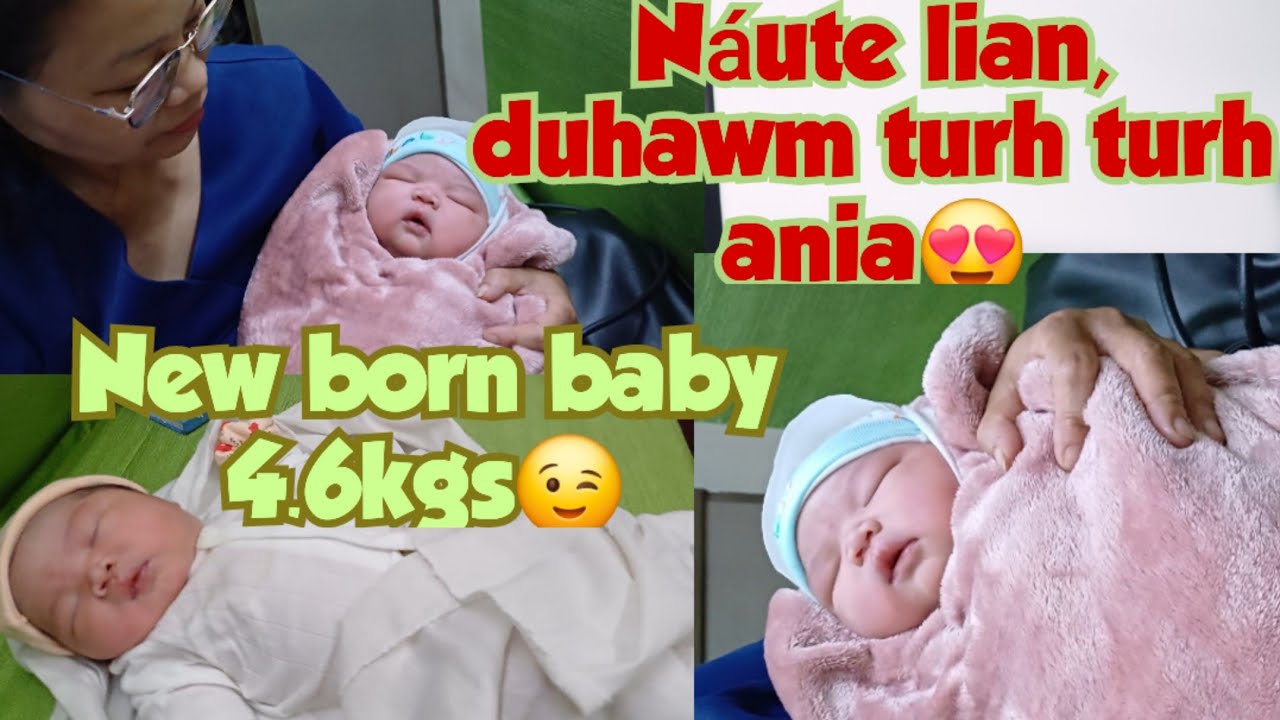 Крупный ребенок (новорожденный весом 4,6 кг).