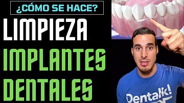 ¿Se pueden cepillar los dientes después de un implante?