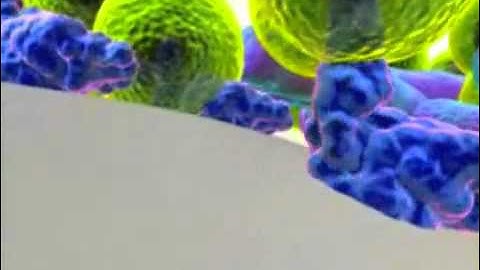 Decay Detection -Animation - Execudent