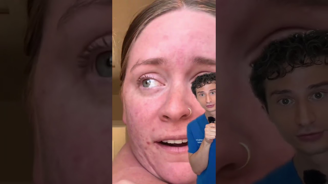 The cyst that gagged me. #dermreacts  #skincare  #dermatologist #dermangelo