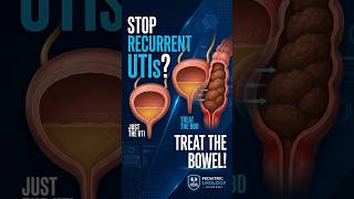 Recurrent UTIs in children It might be BBD #pediatrichealth #uti